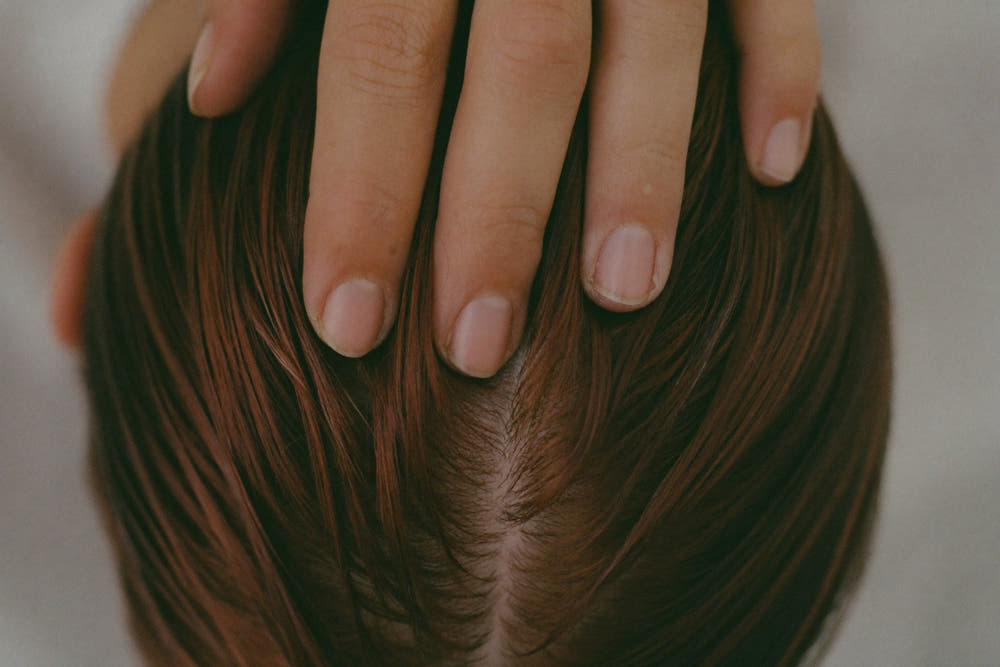 Close-up of fingertips resting on a scalp along a parting in the hair
