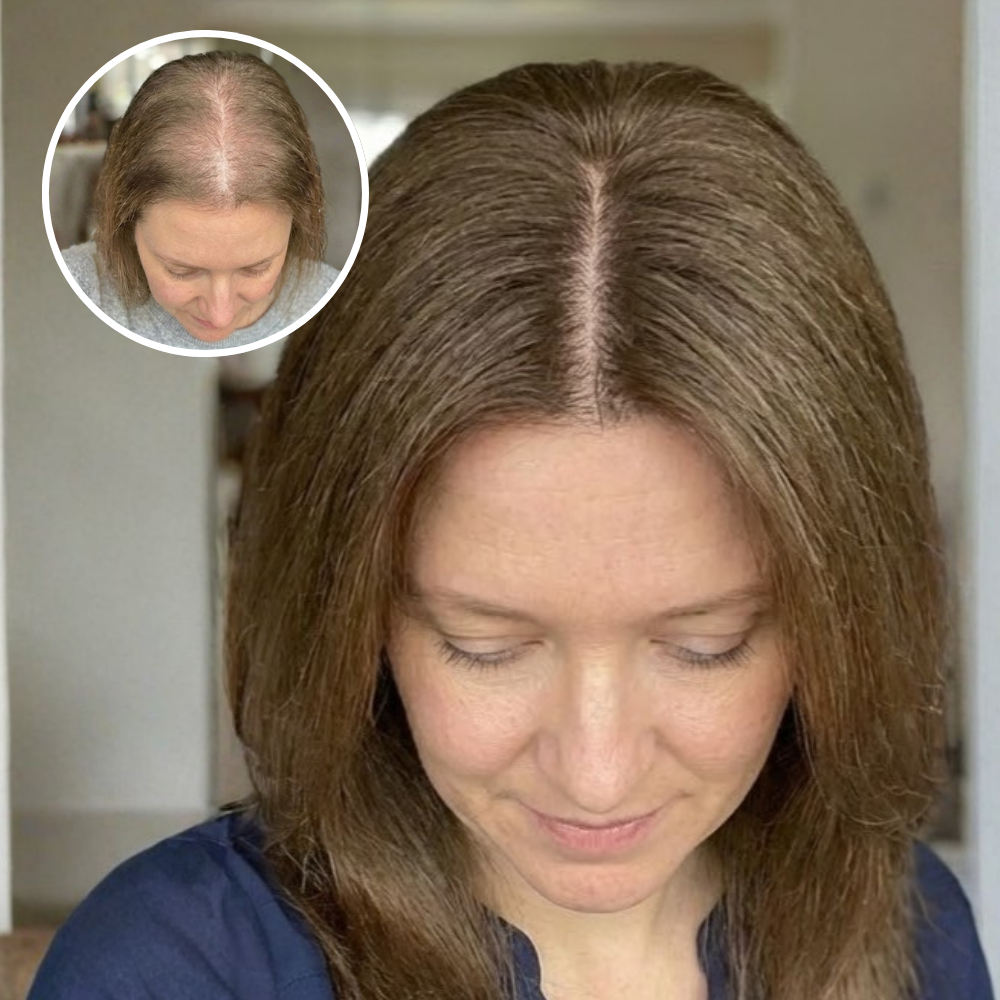 Before and after of a womens hair after using max growth