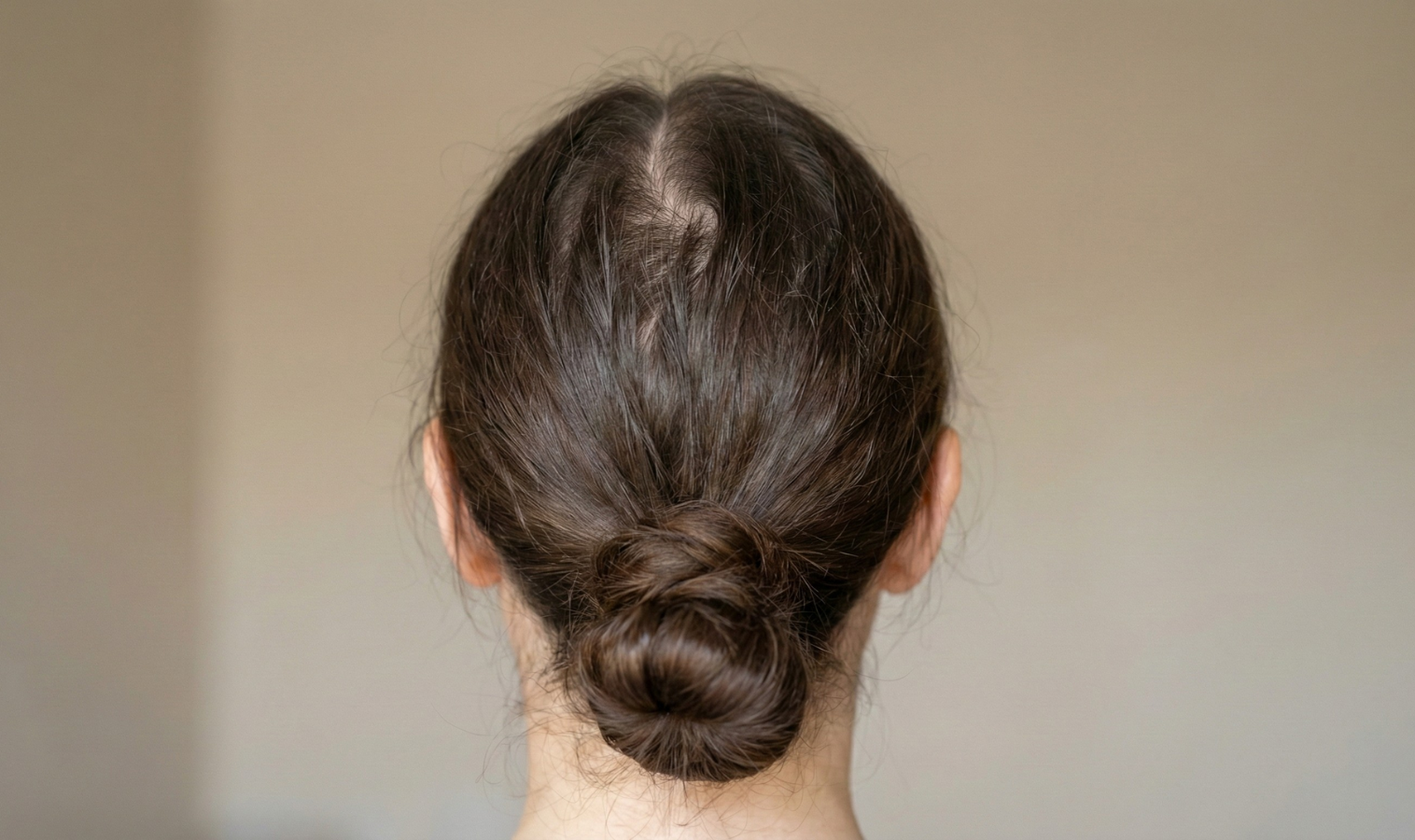 Woman with hair loss at crown