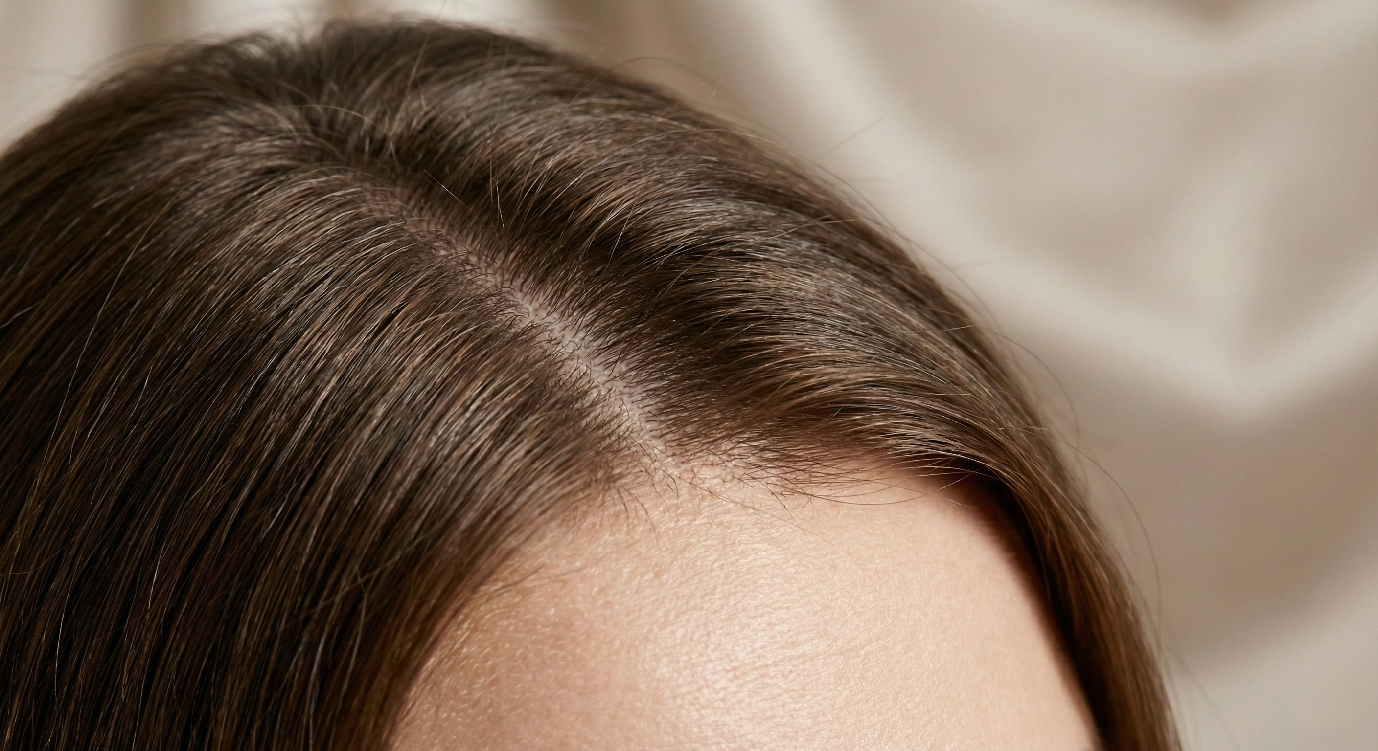 Macro view of a healthy scalp part showing realistic hair density and texture